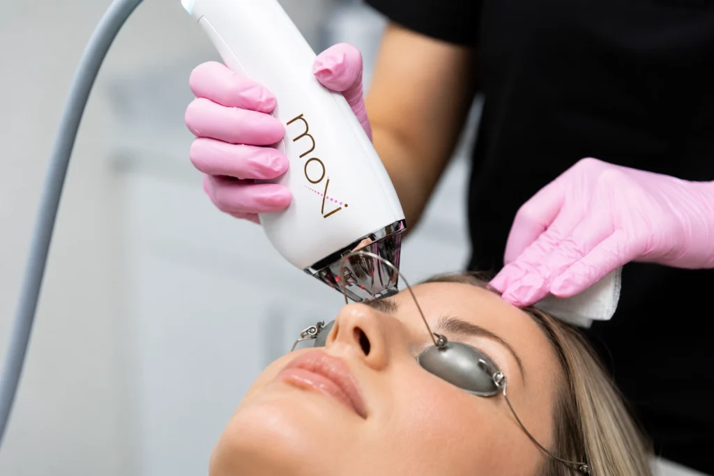 Super Moxi Laser Treatment