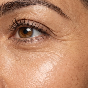 early signs of aging