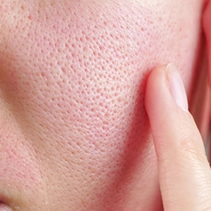 Pores & Skin Texture